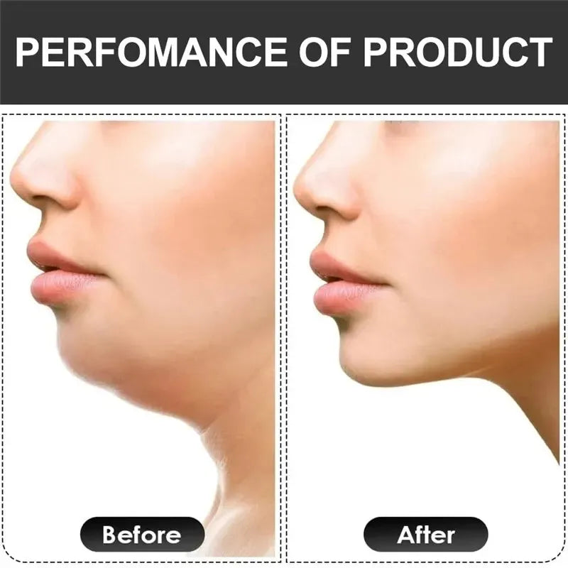 U-shaped silicone jaw exerciser with multiple resistance levels for facial training - product image