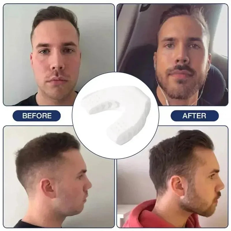 U-shaped silicone jaw exerciser with multiple resistance levels for facial training - product image