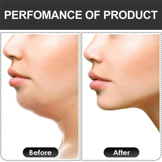 U-shaped silicone jaw exerciser with multiple resistance levels for facial training - product image